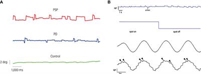 Clinical utility of square-wave jerks in neurology and psychiatry